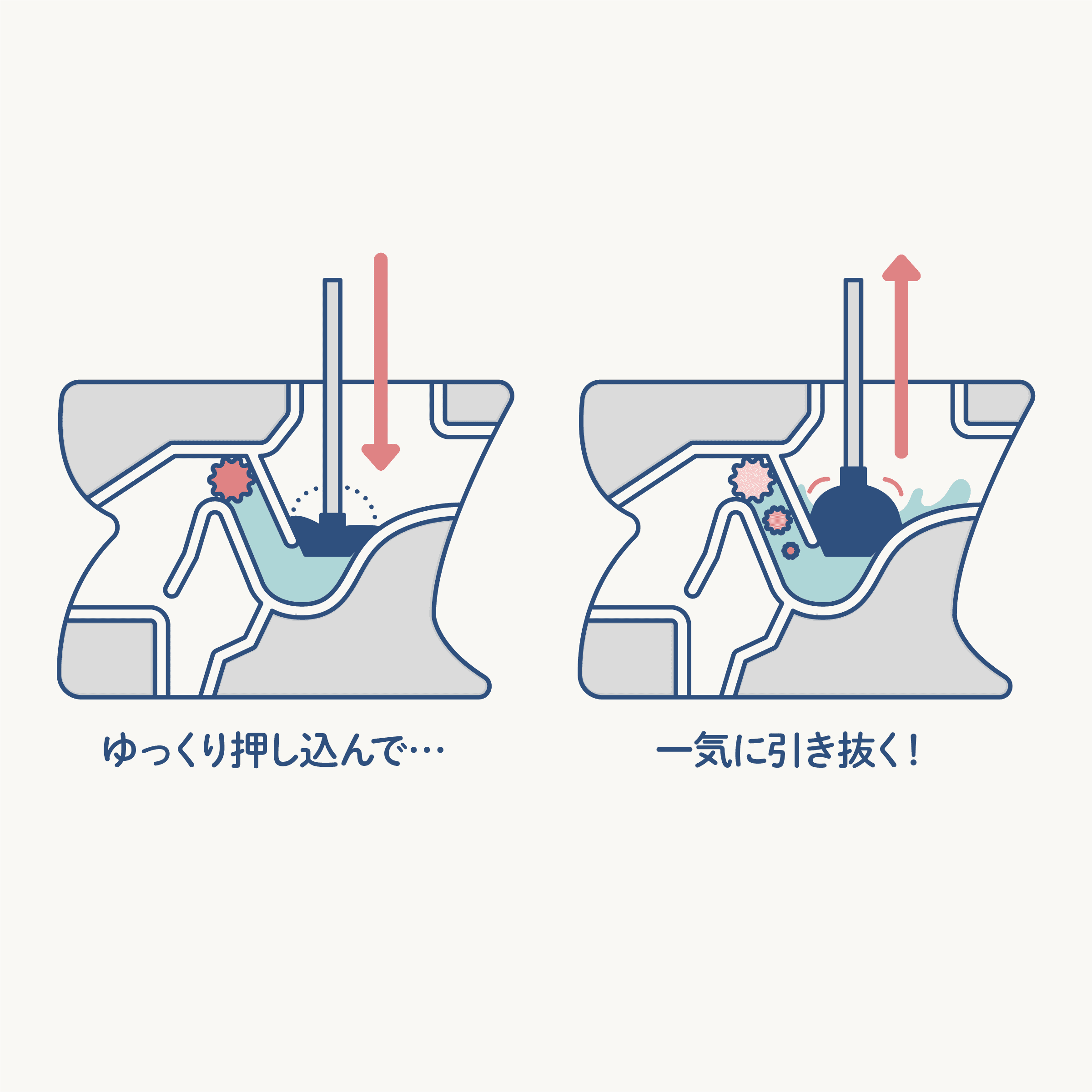 トイレが詰まったら